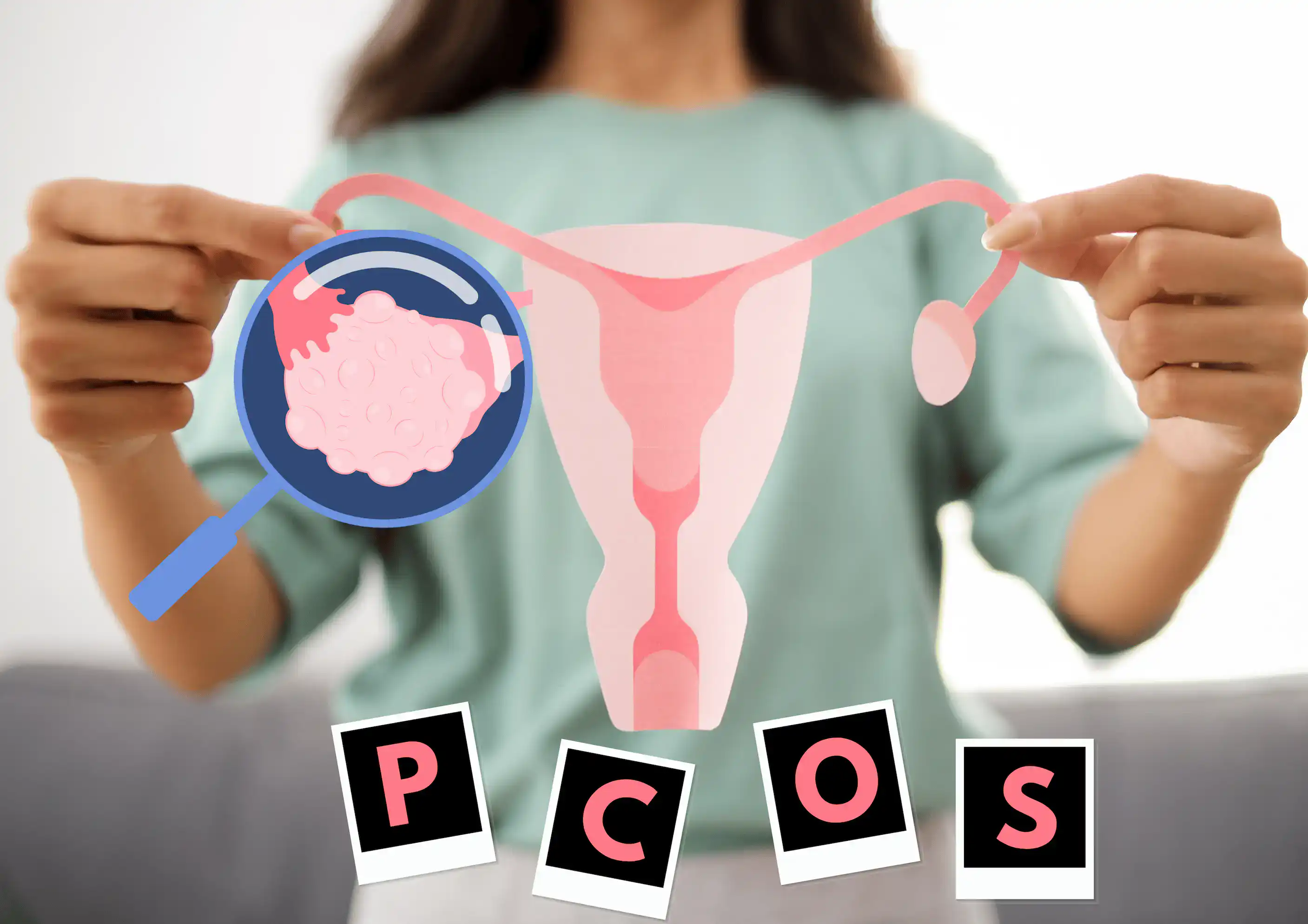 PMOS and PCOS