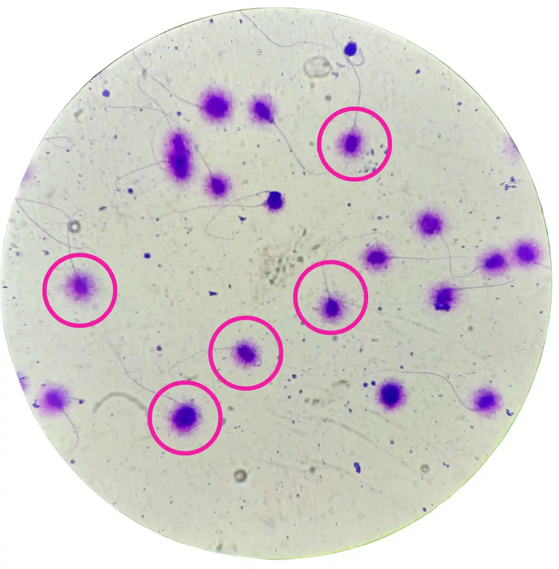 DNA fragmentace spermií